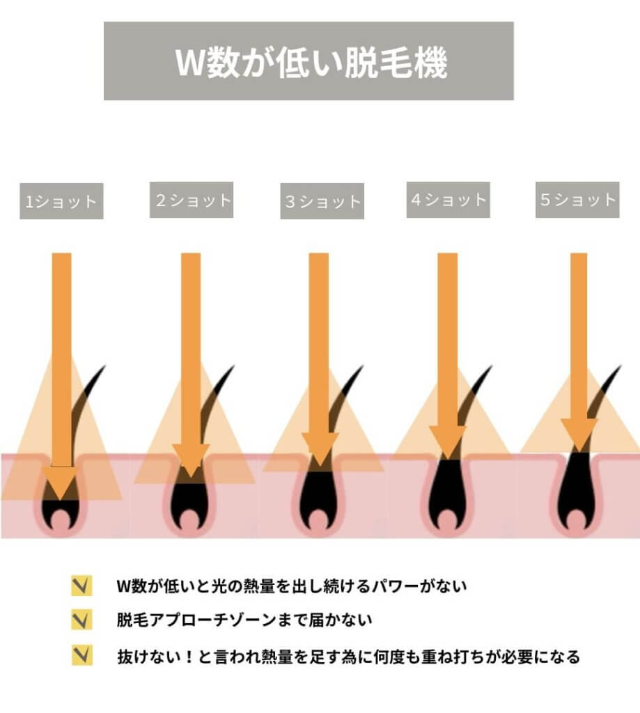 W数が低い脱毛機