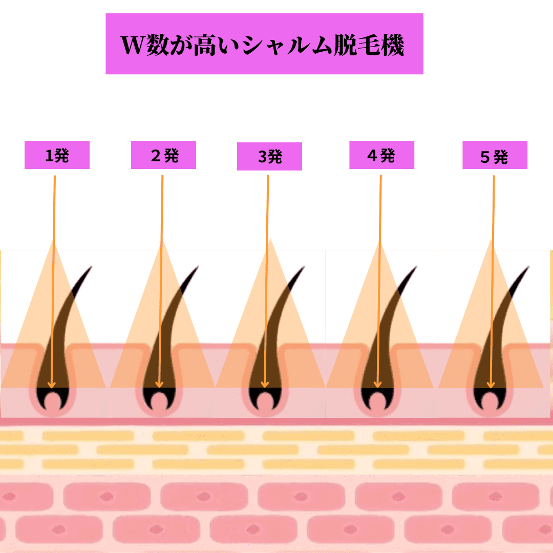 W数が高いシャルム脱毛機